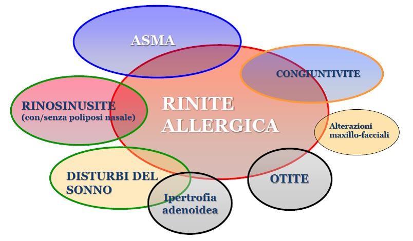 rinite-allergica